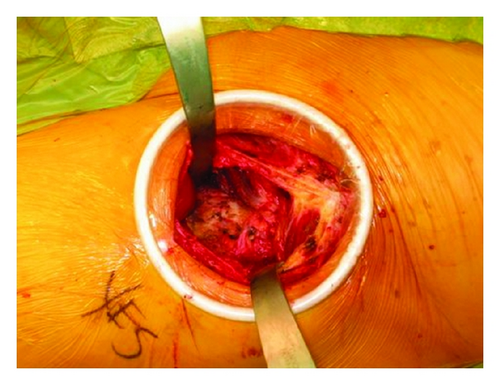 Details are in the caption following the image Details are in the caption following the image