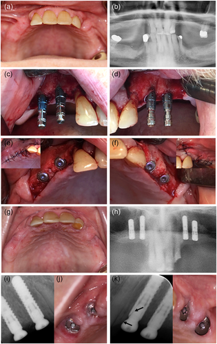 Details are in the caption following the image Details are in the caption following the image