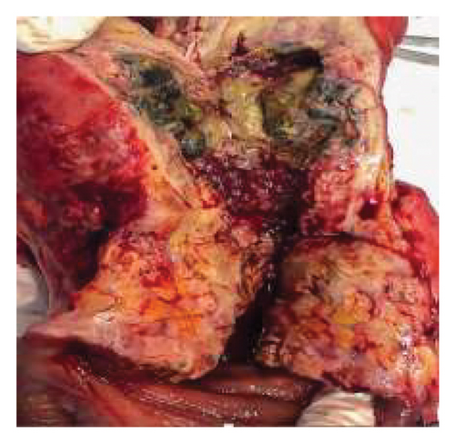 Details are in the caption following the image Details are in the caption following the image
