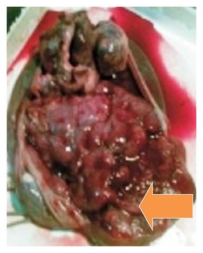 Details are in the caption following the image