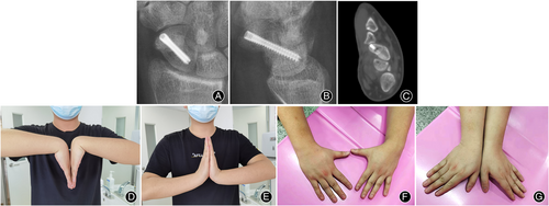 Details are in the caption following the image Details are in the caption following the image