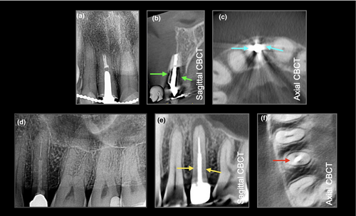 Details are in the caption following the image Details are in the caption following the image