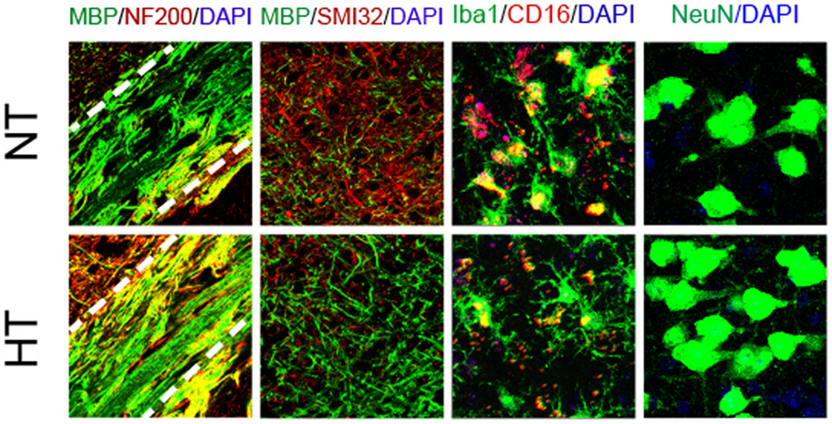 Selective brain hypothermia attenuates focal cerebral ischemic injury and improves long-term neurological outcome in aged female mice