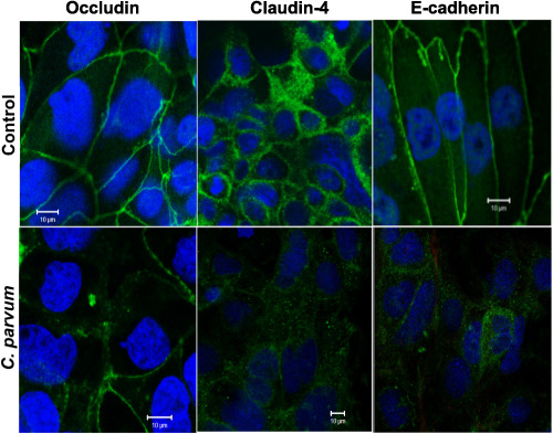 Cryptosporidium parvum disrupts intestinal epithelial barrier function via altering expression of key tight junction and adherens junction proteins
