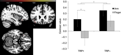 Effects of acute tryptophan depletion on central processing of CT-targeted and discriminatory touch in humans