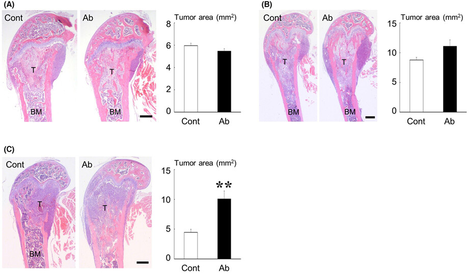 Sclerostin blockade promotes bone metastases of Wnt-responsive breast cancer cells