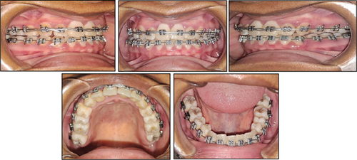 Details are in the caption following the image Details are in the caption following the image