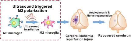 Ultrasound Controlled Anti-Inflammatory Polarization of Platelet Decorated Microglia for Targeted Ischemic Stroke Therapy