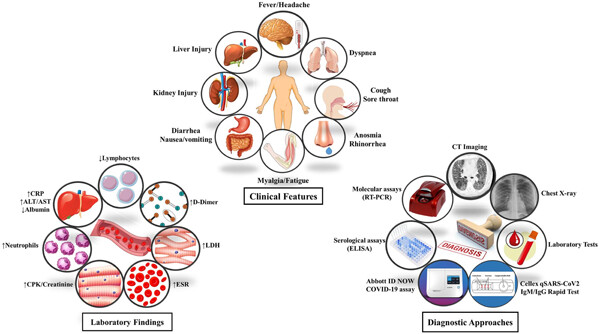 The outlook for diagnostic purposes of the 2019-novel coronavirus disease