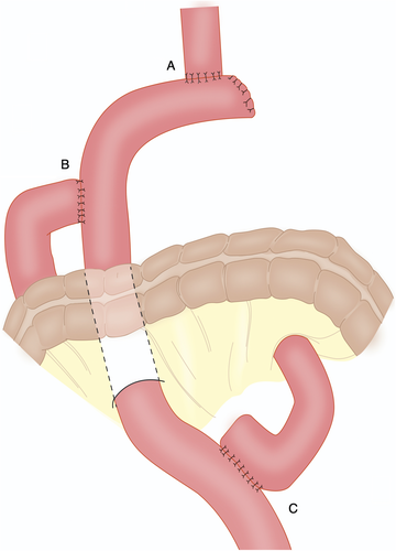 Details are in the caption following the image