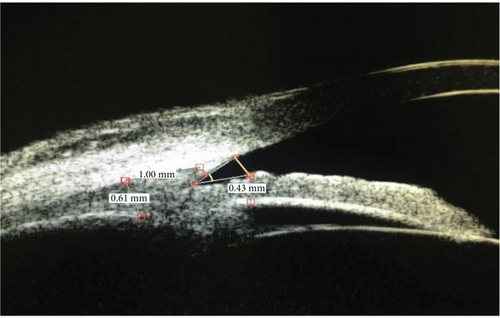 Details are in the caption following the image Details are in the caption following the image