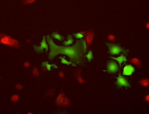 Migration of breast cancer cell lines in response to pulmonary laminin 332