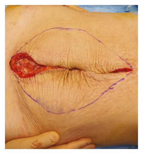 Details are in the caption following the image Details are in the caption following the image