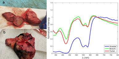 Toward optical spectroscopy-guided lung biopsy: Demonstration of tissue-type classification