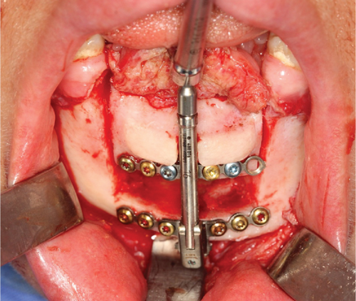 Details are in the caption following the image Details are in the caption following the image
