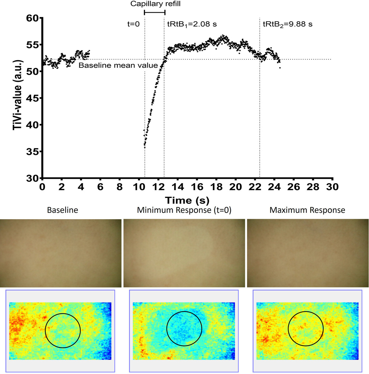 The Effect of Repeated Capillary Refill Tests on the Cutaneous Microcirculation