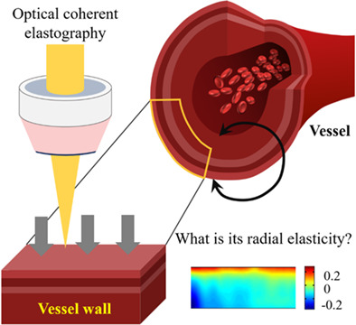 Vascular elasticity measurement of the great saphenous vein based on optical coherence elastography