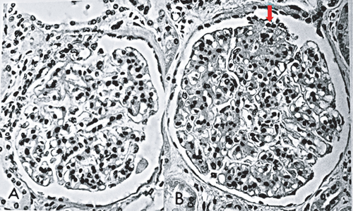 Details are in the caption following the image