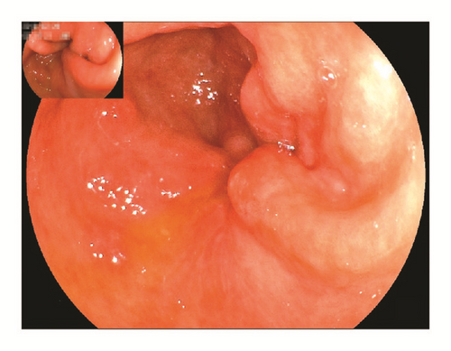 Details are in the caption following the image Details are in the caption following the image