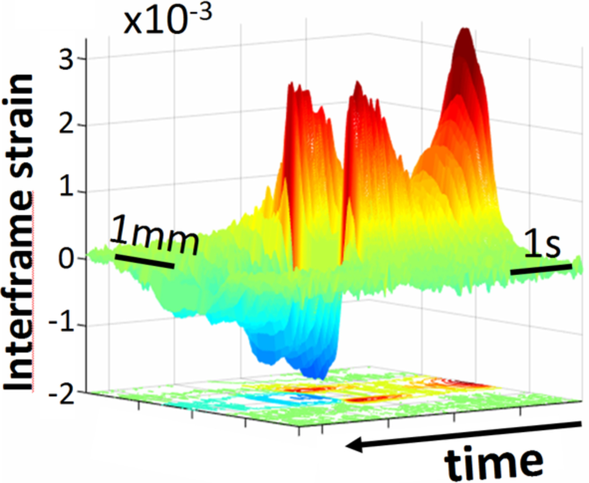 Interplay of temperature, thermal-stresses and strains in laser-assisted modification of collagenous tissues: Speckle-contrast and OCT-based studies