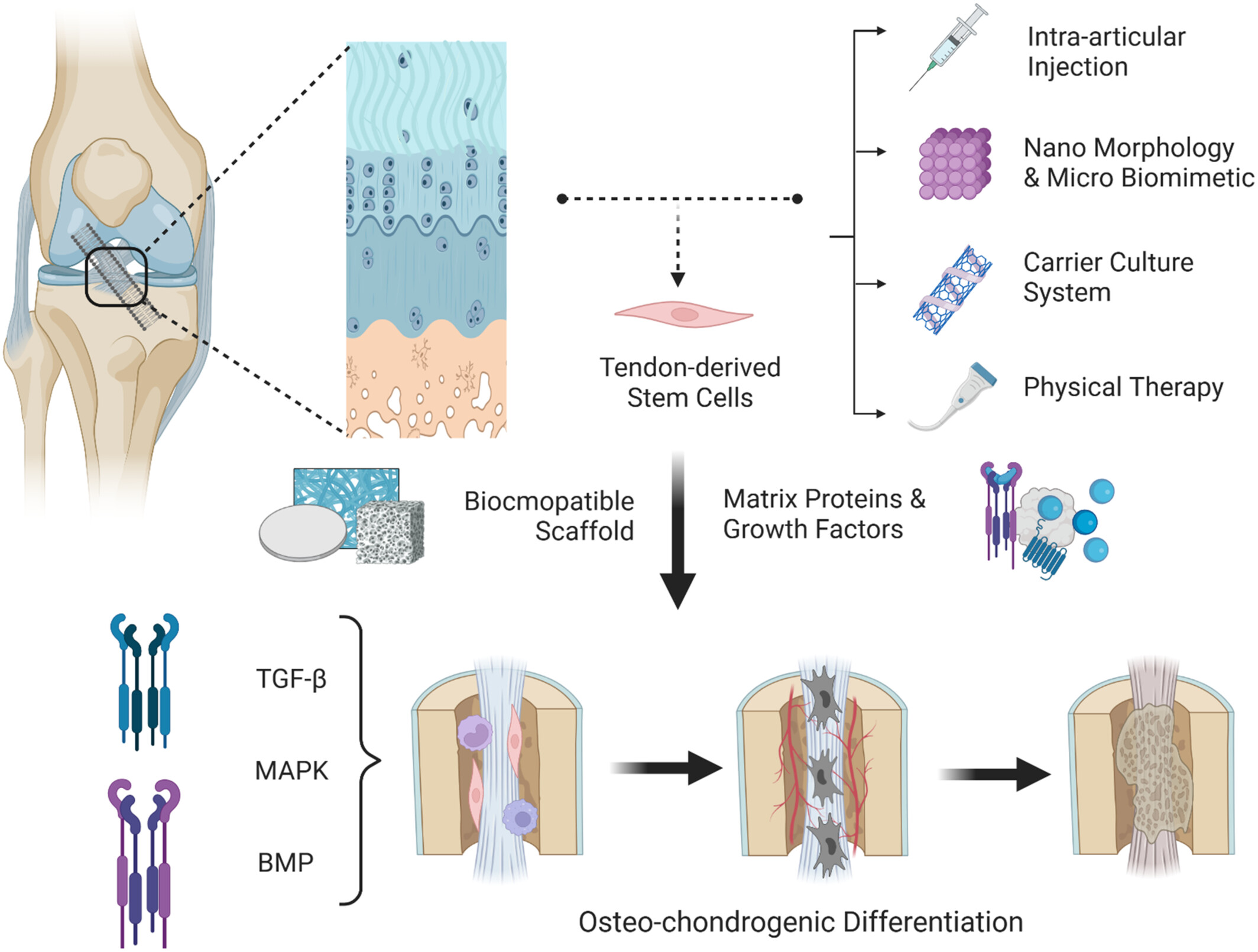 A New Tissue Engineering Strategy to Promote Tendon–bone Healing: Regulation of Osteogenic and Chondrogenic Differentiation of Tendon-derived Stem Cells