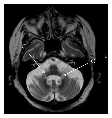 Details are in the caption following the image Details are in the caption following the image