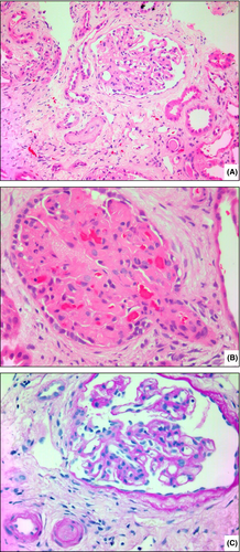 Details are in the caption following the image