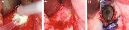 Details are in the caption following the image Details are in the caption following the image