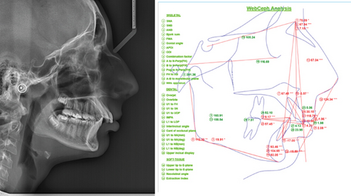 Details are in the caption following the image Details are in the caption following the image