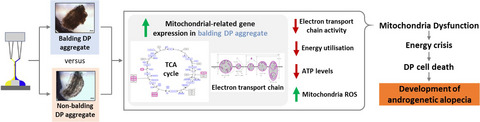 Observations that suggest a contribution of altered dermal papilla mitochondrial function to androgenetic alopecia