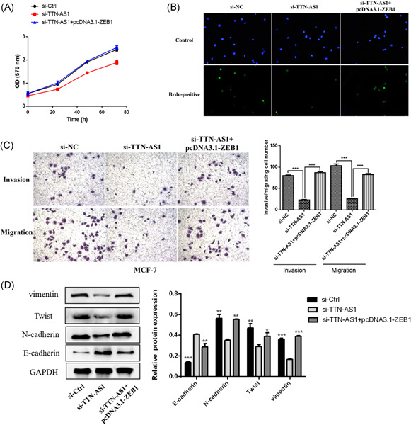 lncRNA TTN-AS1 facilitates proliferation, invasion, and epithelial-mesenchymal transition of breast cancer cells by regulating miR-139-5p/ZEB1 axis