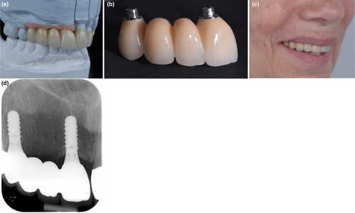 Details are in the caption following the image Details are in the caption following the image