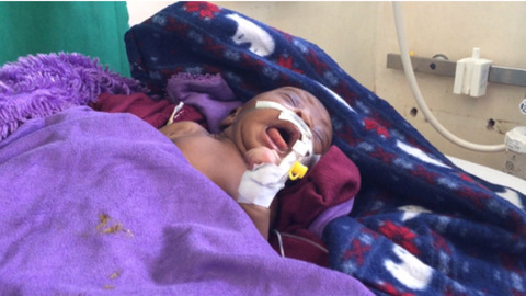 Neonatal tetanus in St. Mary’s Hospital Lacor: A case report