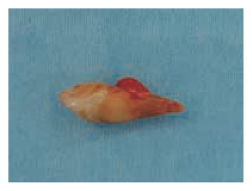 Details are in the caption following the image