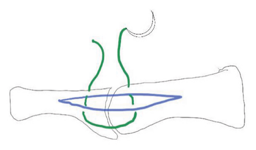 Details are in the caption following the image