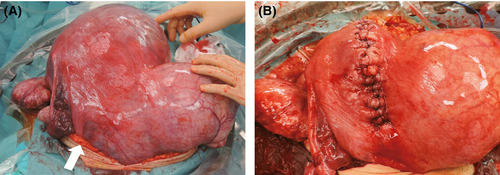 Details are in the caption following the image Details are in the caption following the image