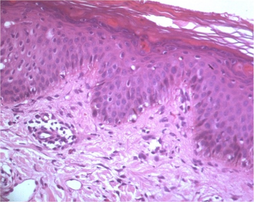 Details are in the caption following the image
