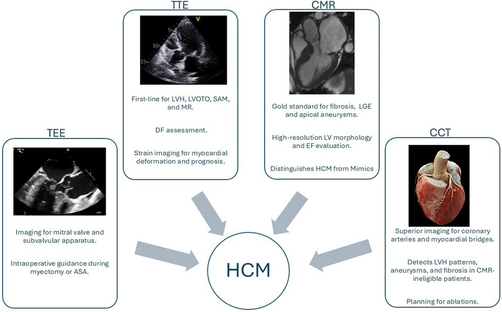 Update on Imaging in Hypertrophic Cardiomyopathy
