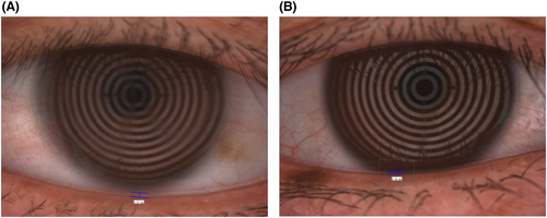Details are in the caption following the image Details are in the caption following the image