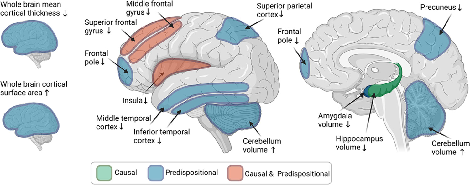 Alcohol use and grey matter structure: Disentangling predispositional and causal contributions in human studies