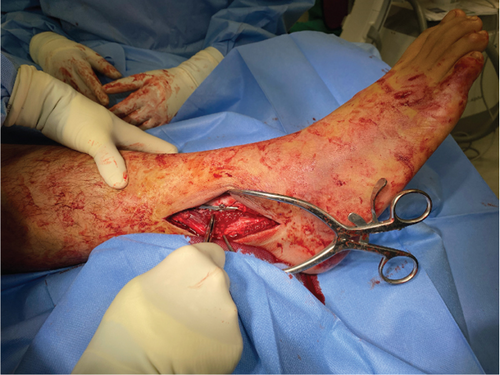 Details are in the caption following the image Details are in the caption following the image