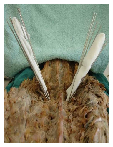 Details are in the caption following the image Details are in the caption following the image