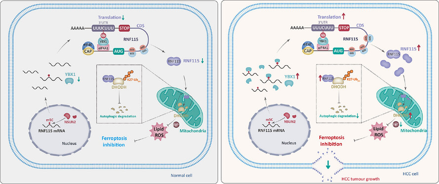 Targeting YBX1-m5C mediates RNF115 mRNA circularisation and translation to enhance vulnerability of ferroptosis in hepatocellular carcinoma