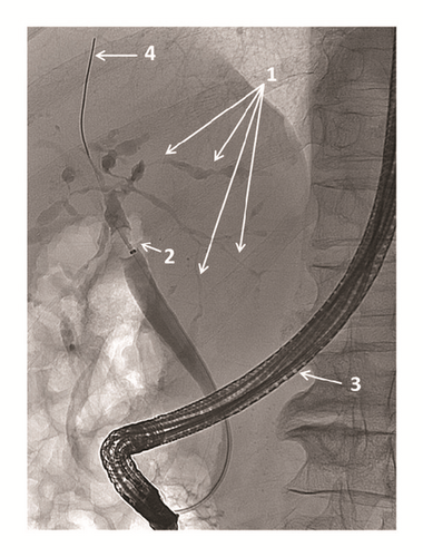 Details are in the caption following the image