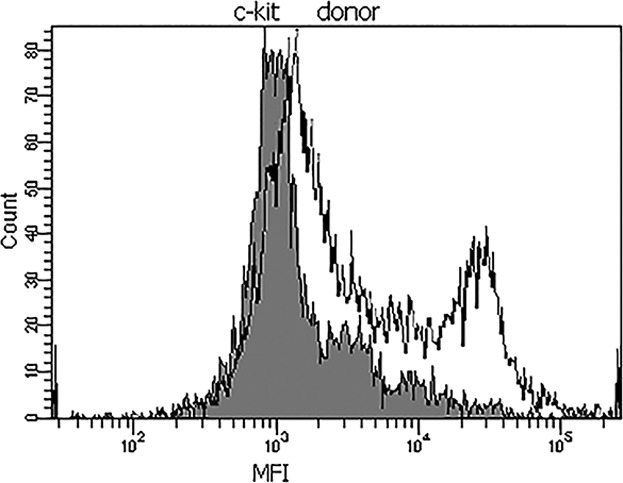 Alterations of oncogenes expression in NK cells in patients with cancer