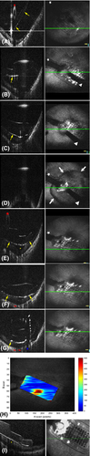 Details are in the caption following the image Details are in the caption following the image