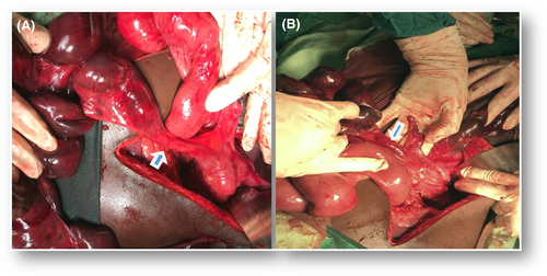 Details are in the caption following the image Details are in the caption following the image