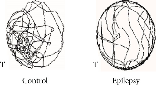 Details are in the caption following the image