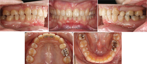 Details are in the caption following the image Details are in the caption following the image
