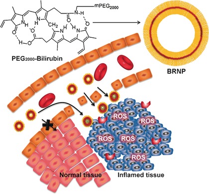 Bilirubin Nanoparticles as a Nanomedicine for Anti-inflammation Therapy